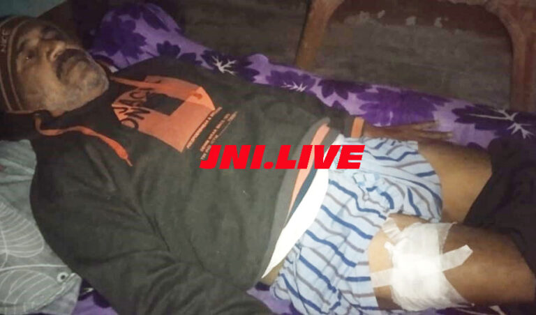 कानपुर से भी घायल मुनीम घर वापस, पैर में पांच दिन से धसी है गोली
