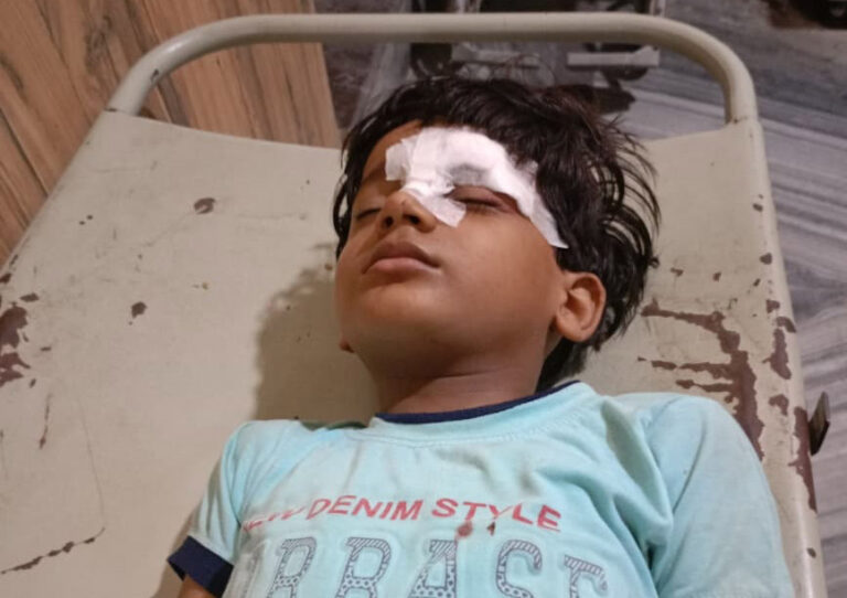 बिजली पोल टूट कर गिरा, बालक गंभीर