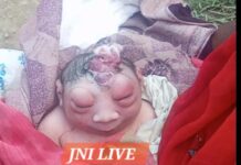 असामान्य चेहरे वाले नवजात के जन्म से क्षेत्र में कौतूहल